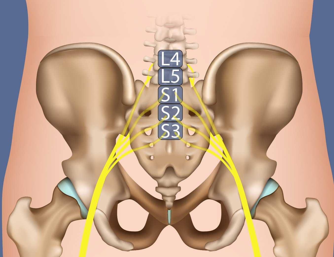 Sciatica Pain Relief - Take pressure off the sciatic nerve