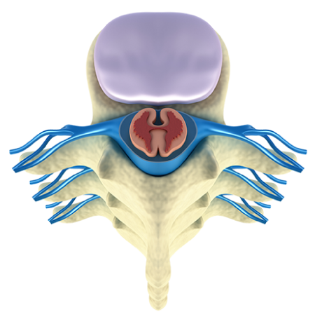 RADICULOPATHY Healthy Disc