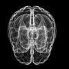 Doctor says Brain Cancer Deaths Should be a Wake-up Call